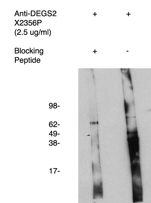 " Western blot using antigen immunoaffinity purified andt DEGS2 antibody (Cat. No. X2356P) on human kidney cell lysate.  Lysate used at 15 µg/lane.  Antibody used at 1:400 dilution.  Secondary antibody, mouse anti-rabbit HRP (Cat. No. X1207M), used at 1:50k dilution. Visualized using Pierce West Femto substrate system. Exposure for 5 minutes
"